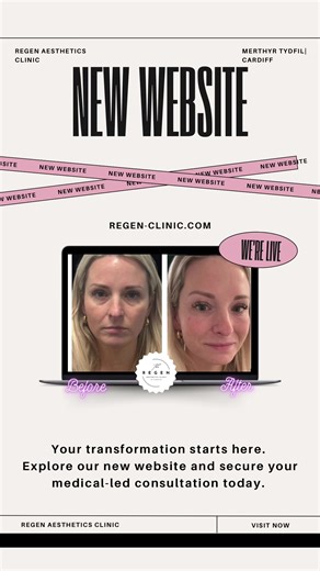 STOP scrolling if you’ve been searching for the best aesthetics clinic in Merthyr Tydfil 👀 The new ReGen Aesthetics Clinic website is officially LIVE. Medical-led regenerative aesthetics, skin rejuvenation, polynucleotides, skin boosters, anti-wrinkle treatments and advanced structural treatments — all now available to book online in South Wales. 🌐 www.regen-clinic.com 📍 Merthyr Tydfil | South Wales #MerthyrTydfil #SouthWalesAesthetics #ReGenAestheticsClinic #MedicalLedAesthetics #SkinRejuven