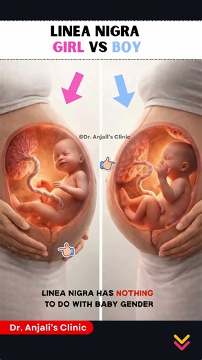 Gender Reveal by Linea Nigra? Boy or Girl? 👦👧