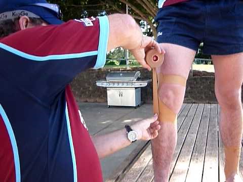 patella instability taping tecnique