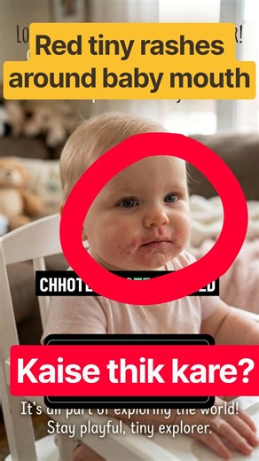 Babies के face पर Rash होने पर क्या करे। Drool rash during teething #teething #drooling #shorts