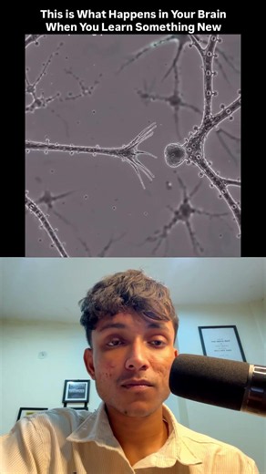 The Science Behind Neural Connections 🧠