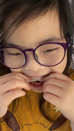 9.3K views · 43 reactions | Taking her first #invisalignsmile steps and we couldn't be prouder  #invisalign #invisalignfirst | Invisalign | Facebook