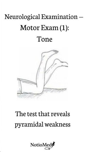 Barré Test Explained (Pronator Drift in #neurology )