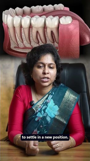 Replase after braces