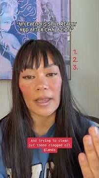 CHALAZION troubleshooting