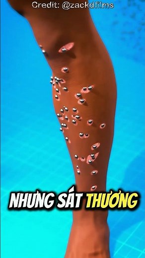 How Claymore Mines Work 😯 (Mechanism Explained)