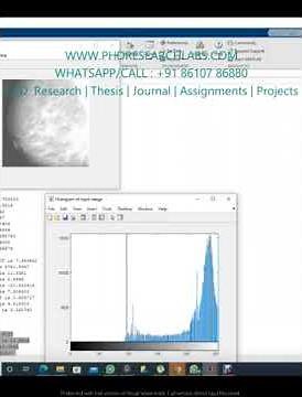 Contrast Limited Adaptive Histogram Equalization for mammography images Matllab CLAHE code - MATLAB