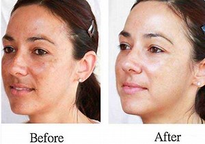 385K views · 19K reactions | Libreng DERMA Tips: Walang bayad po! Paki-SHARE. Pampaganda ng Mukha Pekas, Kulubot Pampaputi Ano ang magandang Sabon, Moisturizer, Make-up, Shampoo Eye Bags. Payo ni Doc Katty Go (Dermatologist) #31 Interview by Doc Willie at Liza LIVE (9/14/17, Part 2) Sa mga nagtatanong, si Doc Katty Go (dermatologist) ay nasa Manila Doctors Hospital. Room 204. Telephone number 524-2838 (direct line) and 558-0888, local 4060. | Doc Willie Ong | Facebook