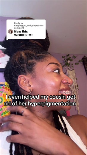 How I Helped My Cousin Get Rid of Her Hyperpigmentation
