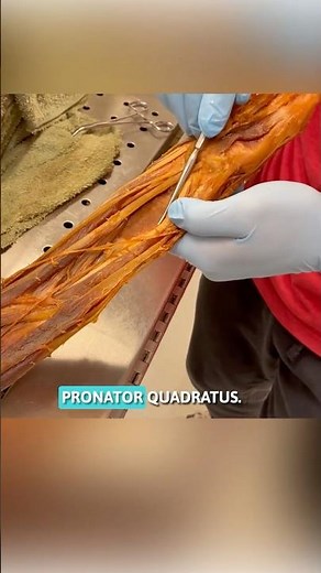 Pronator quadratus muscle