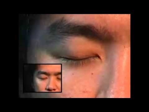 How to remove worms and parasites from the skin and face and body