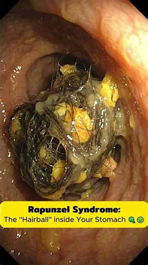 ⚠️What Happens If You Swallow Hair? 😱