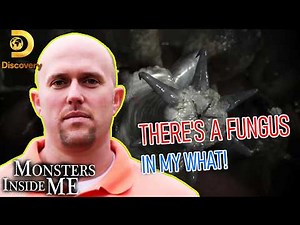 Monsters Inside Me Full Episodes |S06E04⚡There's a Fungus in My What!⚡ | Medical Examiner 2026