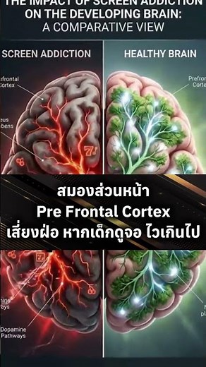 Unlocking the Power of the Prefrontal Cortex 🧠 Why It's More Important Than You Think! #BrainMagic
