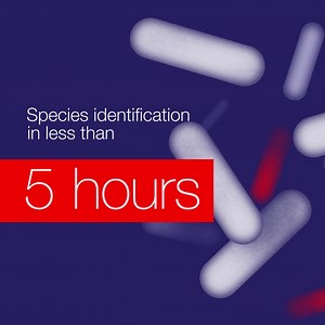 302 reactions · 14 shares | High-throughput, comparative DNA sequencing system for identification of bacteria and fungi. | Thermo Fisher Scientific | Facebook