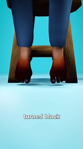 Eating This Fish Caused Amputations 😱 | Zack D. Films