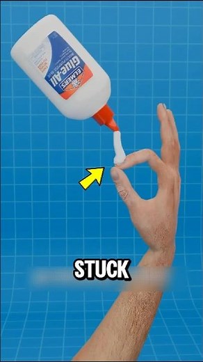 Stuck Fingers with Super Glue? Here’s the Safe Way Out!