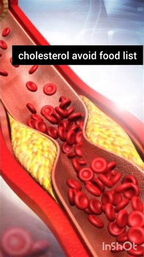 Cholesterol Avoid List #health#avoid#shorts
