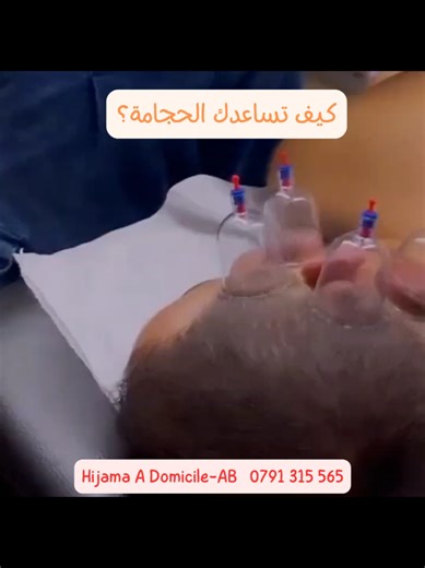 تعاني من طنين الأذن، الانسداد، الدوخة، الضغط داخل الأذن أو ثِقل السمع؟ 💥نوفرلك حجامة منزلية في بيتك مع تنقل مجاني، 👌أدوات معقمة و برتوكولات علاجية ☎️ اتصلي لاخد موعد 0791315565 #حجامة_نسائية_منزلية_الجزائر #طب_نبوي #طنين الادن #حجامة_علاجية