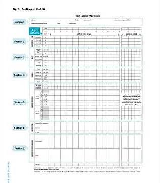 WHO Labour Care Guide. The next generation partograph.