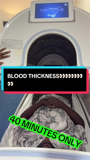 Understanding High Uric Acid and Blood Thickness