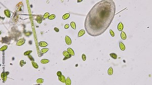 Bacteria and Protozoa in waste water under the microscope.