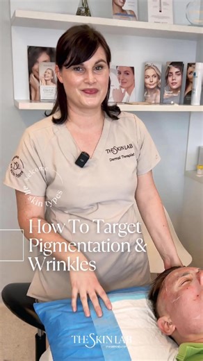 Acne scars aren’t all the same, which is why treatment needs to be targeted, not generic. For pitted acne scarring, the goal is to resurface uneven texture while rebuilding collagen beneath the skin. HALO is a hybrid laser that works on both the surface and deeper layers of the skin at the same time. It resurfaces the top layer to smooth texture, while stimulating collagen and elastin underneath to support long-term skin renewal. This dual-action approach makes HALO especially effective for impr