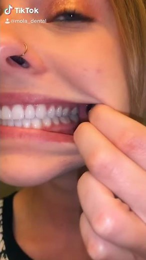 How to Determine your Occlusion