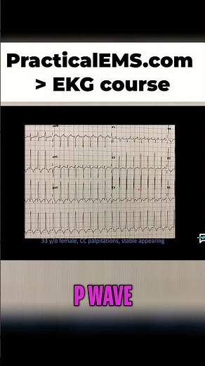 EKG Interpretation: Orthodromic AVRT vs. Antidromic AVRT