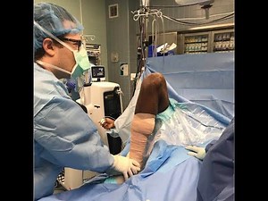 Episode 2: The Knee Debridement & Manipulation