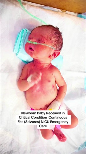Newborn Baby Received in Critical Condition Continuous Fits (Seizures) NICU Emergency Care. #premature #cute #BabyCare #BabyInNICU #NICUCare