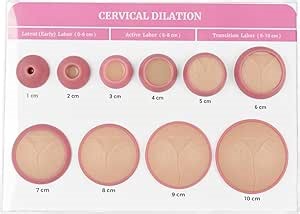 Amazon.com: JeeKoudy Cervical Dilation Simulator with 1-10cm, Gynecological Teaching Model, Dilation Simulator Manikin for Midwife and Doula Training, Medical Education and Birth Learning