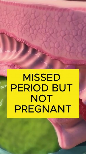 MISSED PERIOD BUT NOT PREGNANT #period #menstrual #menstrualcrampssupplement #menstrualpain #Menstrualdisorders #treding #new #health #philippines #vairl #strongest #menstrualcare #affiliatemarketing #Menstrual #hormony #anes #hari #insomnia #nightsweat #pill