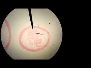 Ascaris, microscopic