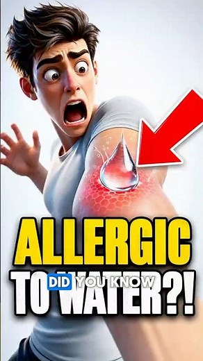 Some People Are Allergic to WATER 😳