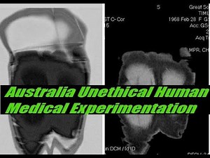 Wireless Body Area Network (WBAN) Virtual healthcare service