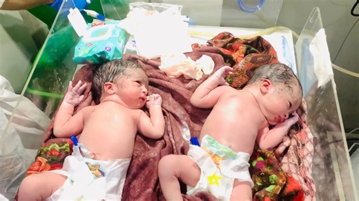Emotional Twin Birth Story 💖 | One Baby’s First Cry Delay & Special Observation Moments #baby #babycare #nicucare #newborn #nicucare Witness the emotional and heartwarming first moments of our adorable twin newborn babies! 💖 One little angel took a few moments longer to cry, while the other was carefully observed, cleaned, and lovingly cared for by our NICU team. 👩‍⚕️👶 From gentle suction and full-body cleaning to that precious first cry, every second of this video shows the miracle of new l
