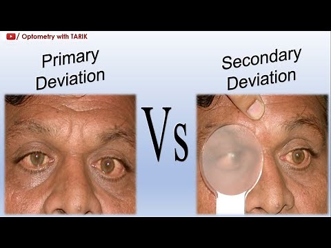 Understanding Primary & Secondary Angle of Deviation