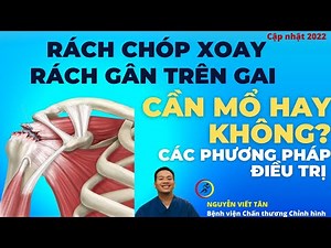 Rách gân trên gai (rách gân chóp xoay) đau vai có cần phải mổ không? Các phương pháp điều trị.