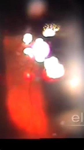 Ibrahim Saleh | ‎Panretinal Photocoagulation (PRP) 🔬 إجراء ليزري علاجي يُستخدم في اعتلال الشبكية السكري المنمّي، حيث تؤدي قلة التروية إلى نمو أوعية دموية...‎ | Instagram
