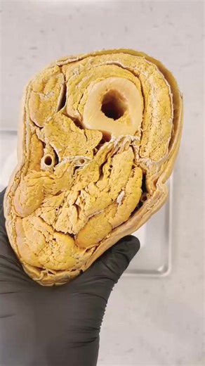 Inside a Real Human Thigh#humen #body #fitness #fit #abs #healthy #gymlife #life #Doctor #reels #shorts | Human Anatomy