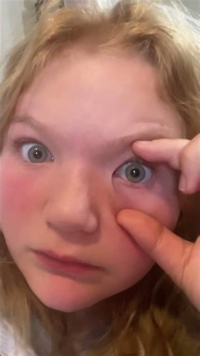 Checking how dilated my pupils are.Day 2