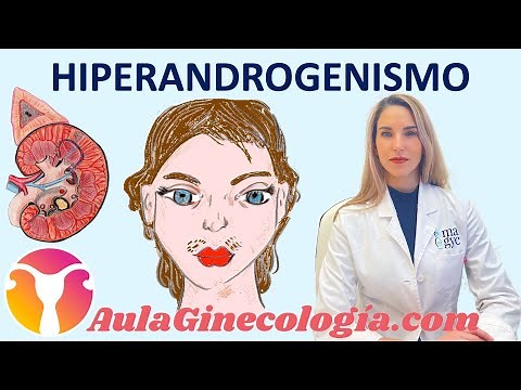 Hyperandrogenism: PCOS, Adrenal Hyperplasia, Congenital Adrenal Hyperplasia... - Gynecology and O...