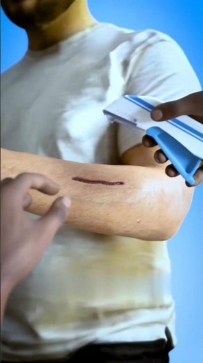 How Medical Staples Work 😱