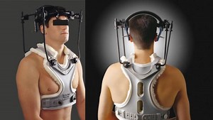 Craniocervical Junction Disorders - Brain, Spinal Cord, and Nerve Disorders - Merck Manual Consumer Version