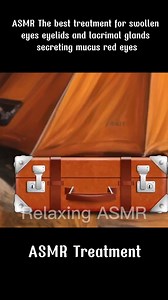 3.3K views · 11 reactions | ASMR The best treatment for swollen eyes, eyelids and lacrimal glands .... | Nikolas Bushi | Facebook