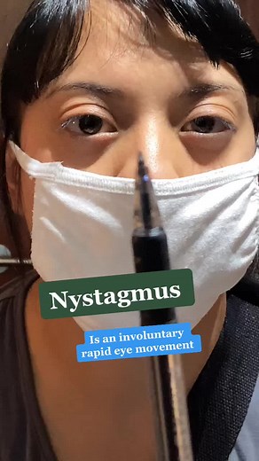 Understanding Nystagmus in LASIK Procedures