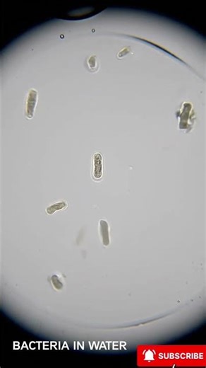 This Is How Bacteria Move Under a Microscope #science #experiment #facts #water #coolscience