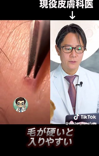 埋もれ毛の原因と対策を皮膚科医が解説