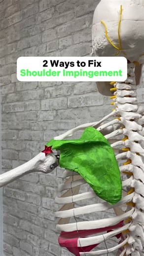 Do you experience pain in the shoulder when reaching overhead or behind your back? Does it feel like something is pinching in there? Well you may be experiencing shoulder impingement syndrome. This means the structures that exit the shoulder joint are literally being pinched. One number one way you have to thing about fixing it is by creating more space in the joint. There are several ways we can achieved this and in this video I show two excellent options. Give this a try and let me know if it 